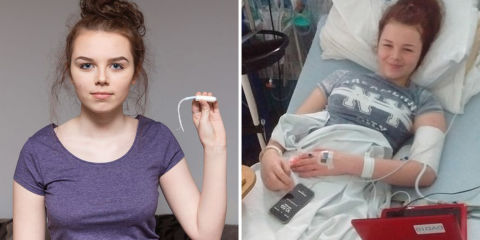 toxic shock syndrome